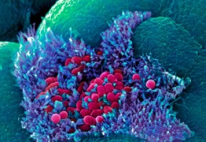 helpful bacteria bacteria in human gut